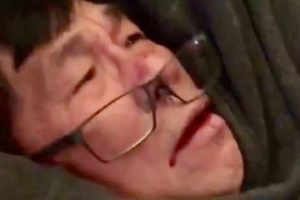 Dr. David Dao after his forcible ejection from a United flight.